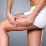 le meilleur traitement anti cellulite